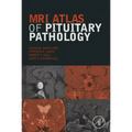 MRI Atlas of Pituitary Pathology