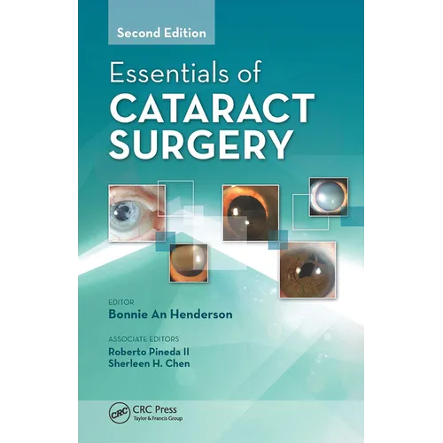 Essentials of Cataract Surgery