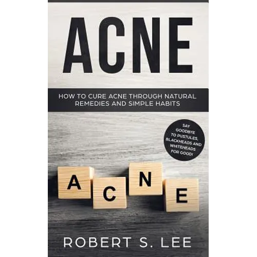 Acne: How to Cure Acne through Natural Remedies and Simple Habits. Say Goodbye to Pustules, Blackheads and Whiteheads for Good!