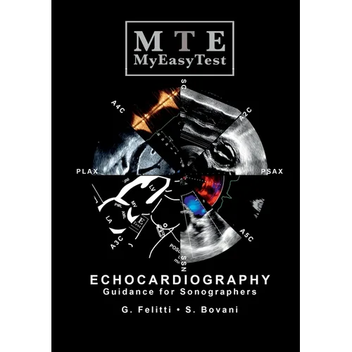 Echocardiography - MyEasyTest