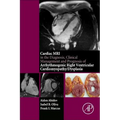 Cardiac MRI in Diagnosis, Clinical Management, and Prognosis of Arrhythmogenic Right Ventricular Cardiomyopathy/Dysplasia