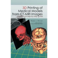 3D Printing of Medical Models from CT-MRI Images: A Practical step-by-step guide