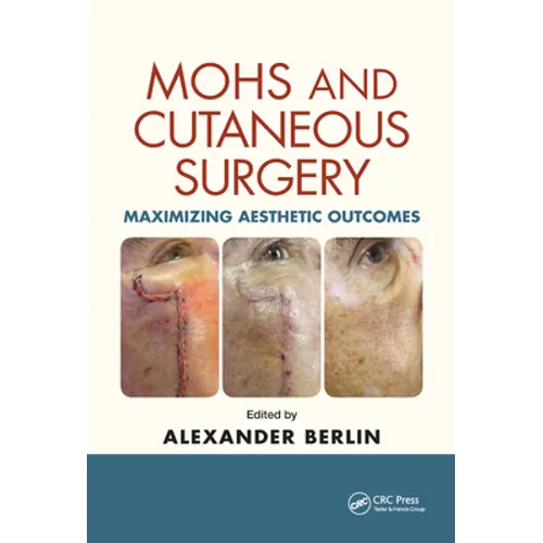 Mohs and Cutaneous Surgery: Maximizing Aesthetic Outcomes