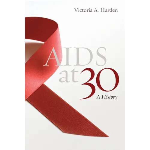 AIDS at 30: A History