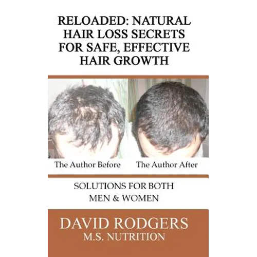 Reloaded: Natural Hair Loss Secrets for Safe, Effective Hair Growth