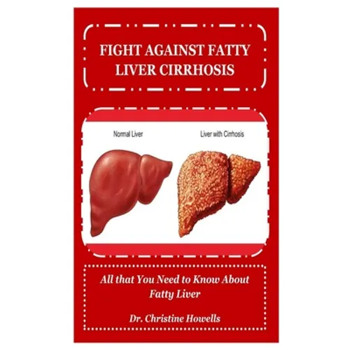 Fight Against Fatty Liver Cirrhosis: All that You Need to Know About Fatty Liver