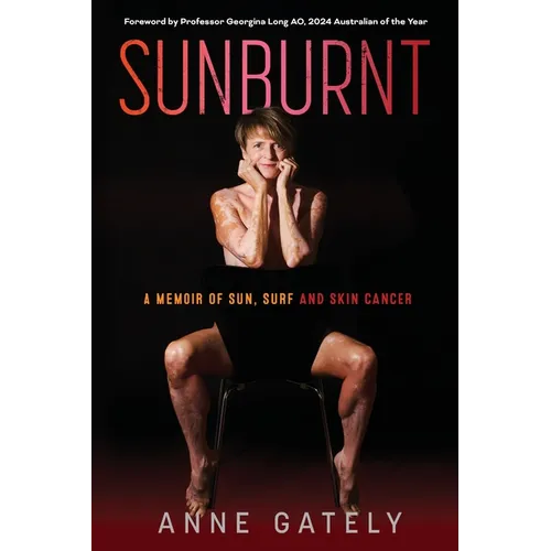 Sunburnt: A memoir of sun, surf and skin cancer